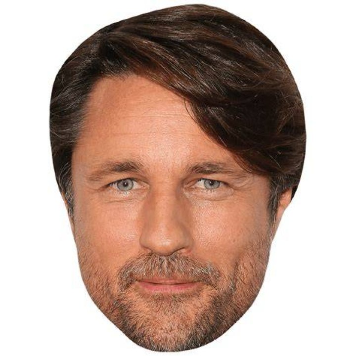 Martin Henderson Face Change: A Detailed Exploration